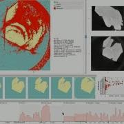 GEMSe Visualization Guided Exploration Of Multi Channel Segmentation Algorithms