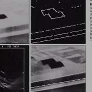 Hoge Detection Image Processing Unit 4 Part 2