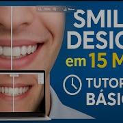 SMILE DESIGN No 3Shape Em 15 Minutos Tutorial Para Iniciantes Na Odontologia Digital