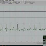 ECG Lab Data Recording And Measurement Dr Brian Carson