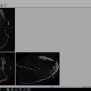 Skyscan MicroCT Analysis 2 3 Alignment Of Data Orientation And Segmentation Of Dataset