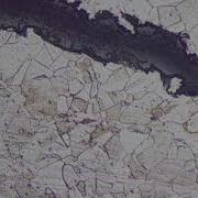 Microstructure Analysis Austenitic Stainlesssteel Failureanalysis Transgranular