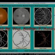 Retinal Blood Vessel Extraction In Fundus Images Matlab Final Year IEEE Project VesselSegmentation