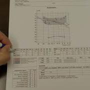 How To Read Your Hearing Test