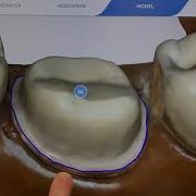 CEREC Scanning Tutorial