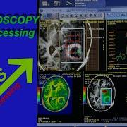 MR Spectroscopy Post Processing MRS Post Processing How To Do MRS Post Processing In GE READYView