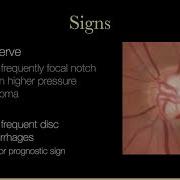 Lecture General Principles Of Glaucoma Management