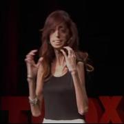 How Do You Define Yourself Lizzie Velasquez TEDxAustinWomen
