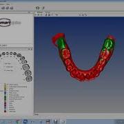 Point Pair Registration Of 3D Dental Arches STL Models In CloudCompare