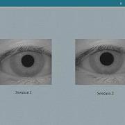 Iris Recognition System MATLAB Based