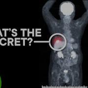 How PET Scans See Cancer