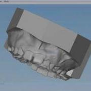 OrthoSelect Demo Video
