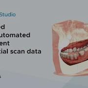 AI Based Fully Automated Alignment For Partial Scan Data Imagoworks Technology 2021 Jun
