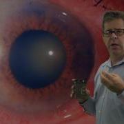 Acute Angle Closure Glaucoma In 1 Coffee