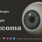 Development Of Glaucoma Animation Open Angle Vs Angle Closure Glaucoma Glaucoma Eyetreatment
