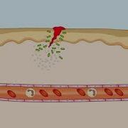 Animation 24 1 Inflammatory Response