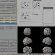Surface Rendering In SPM