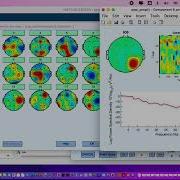 Tutorial For Basic Preprocessing Of EEG Signals Using EEGLAB