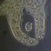 Amoeba Eats Paramecia Amoeba S Lunch Amoeba Endocytosis Phagocytosis Part 1