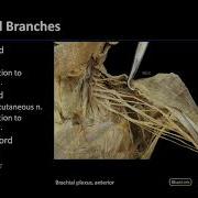 Brachial Plexus M1 Dissection Supplement