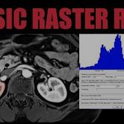 FireVoxel Tutorial 3 Raster ROIs