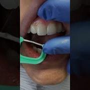 Are You Flossing Properly You May Be Surprised Dentist Dentalhygienist