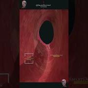 A Journey Inside A Beating Heart