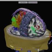 Neuroguide Loreta Absolute Power