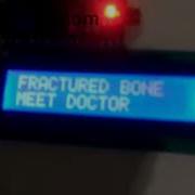 Bone Fructure Detection Using Matlab SVM Image Processing Artificial Intelligence Machine Learning R
