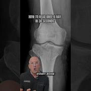How To Read Knee X Rays Like A Surgeon