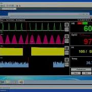 Patient Monitor Simulator For Windows First Look