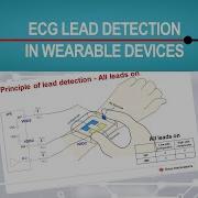 Electrocardiogram ECG Lead Detection In Wearable Devices
