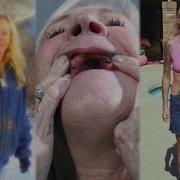 Millions Reported Problems With Dental Implants