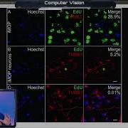 Python Computer Vision Pt 2 VDB Computational Biology