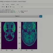 7 Preprocessing In Python Part 1