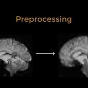 SPM Tutorial 4 A Introduction To Preprocessing