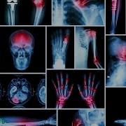 The Effects Of Low Level Lead Exposure In Adults