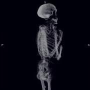 Bones MustBeARealDragWakingUpAndBeingYou Extended Version