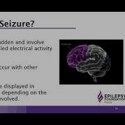 Generalized Seizures 101