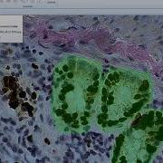 Regions Of Interest Celleste Image Analysis Software