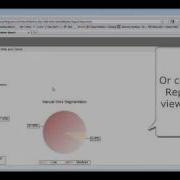 How To Use The Visual WebGui Automatic Migration AssessmentTool