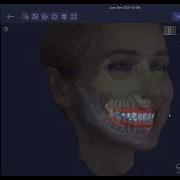 RAYFace RAYFusion