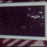 Xperia X10 Quadrant Test Mp4