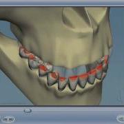 Dental Occlusion