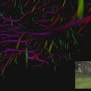 Three Dimensional Reconstruction Of Botanical Trees With Simulatable Geometry