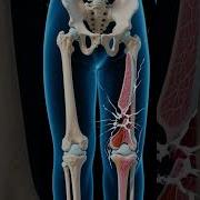 Bone Healing After A Fracture 3D Animation BoneHealing FractureRecovery SkeletalSystem