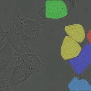 Cell Segmentation For All Microscopy Images