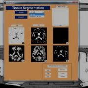 Matlab Thesis Matlab Thesis Topics Academic College Projects