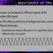 2 Characterizing The EEG Signal