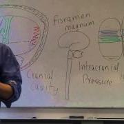 Brain And Head Injuries Lesson 1 Introduction Intracranial Pressure And Level Of Consciousness